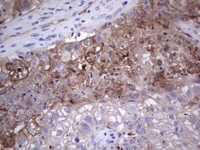 Immunohistochemistry: u-Plasminogen Activator/Urokinase Antibody (OTI5H4) - Azide and BSA Free [NBP2-74793]