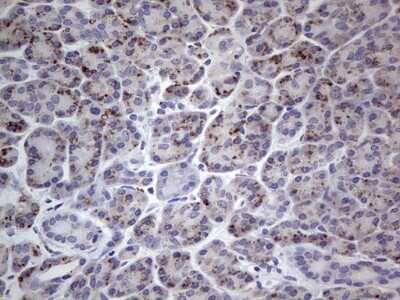 Immunohistochemistry: u-Plasminogen Activator/Urokinase Antibody (OTI5H4) - Azide and BSA Free [NBP2-74793]