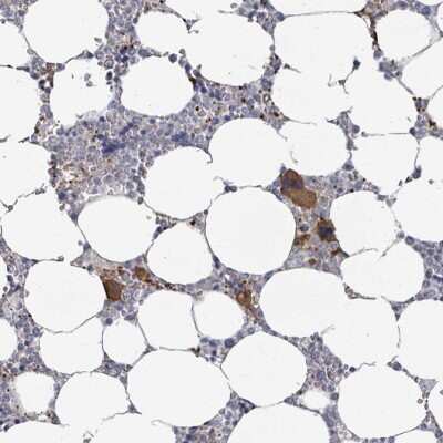 Immunohistochemistry-Paraffin: uPAR Antibody [NBP2-14711]
