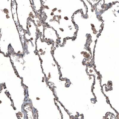 Immunohistochemistry-Paraffin: uPAR Antibody [NBP2-14711]