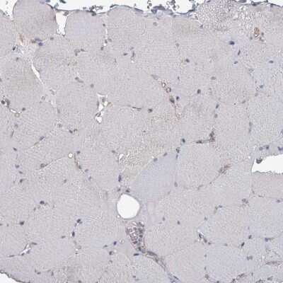 Immunohistochemistry-Paraffin: uPAR Antibody [NBP2-14711]