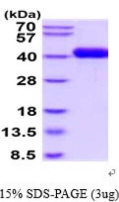 SDS-PAGE: Recombinant Human uPAR His Protein [NBP2-52381]