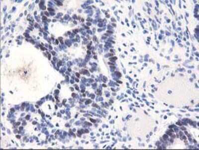 Immunohistochemistry-Paraffin: UNG Antibody (OTI1A11) [NBP2-01194]