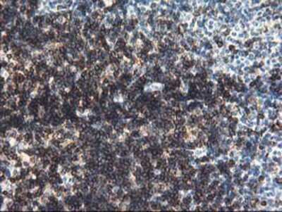 Immunohistochemistry-Paraffin: UNG Antibody (OTI1A11) [NBP2-01194]