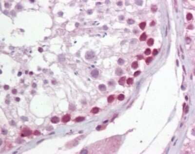 Immunohistochemistry-Paraffin: UNG Antibody [NB600-1031]