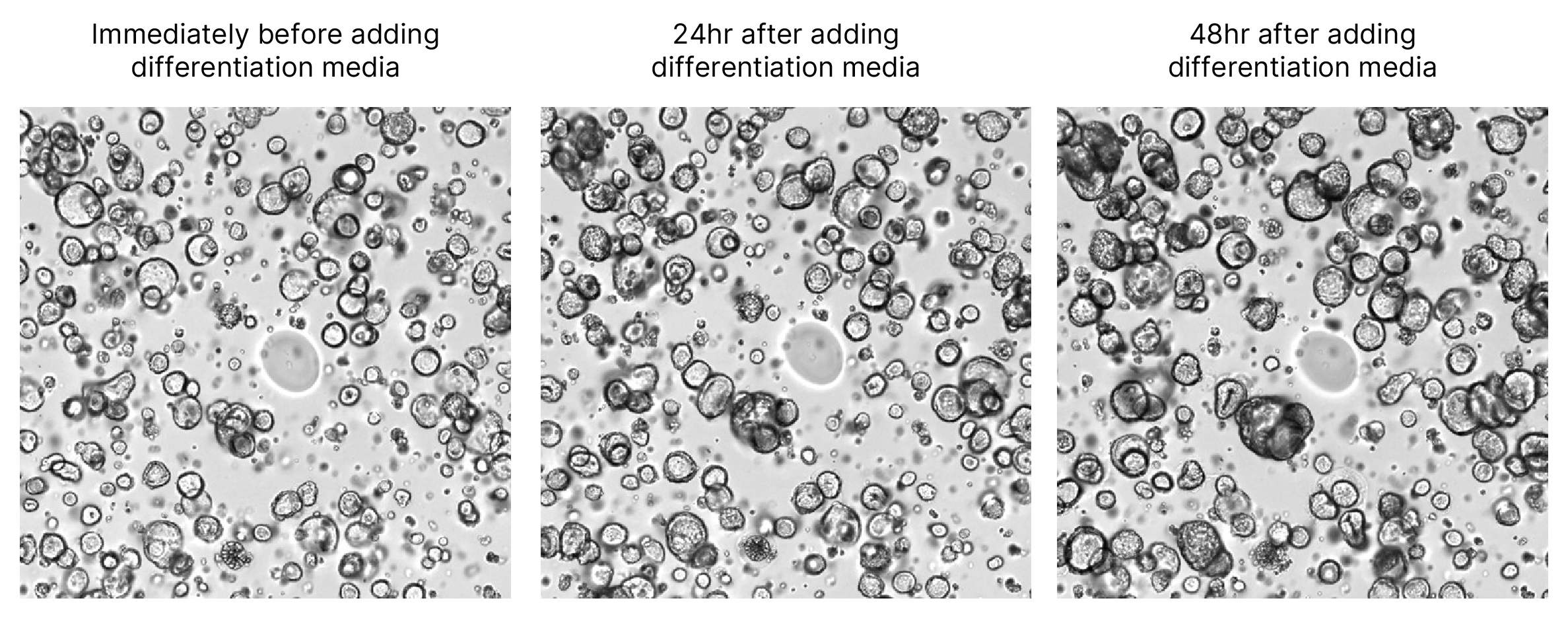 Organoids grown in Cultrex Synthetic Hydrogel show intestinal-like characteristics as they differentiate.