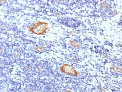 Immunohistochemistry-Paraffin: Von Willebrand Factor Antibody (VWF/1859R) - Azide and BSA Free [NBP3-08963]
