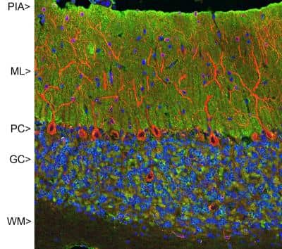 Immunohistochemistry: visinin-like 1 Antibody (2D11) [NBP2-25166]