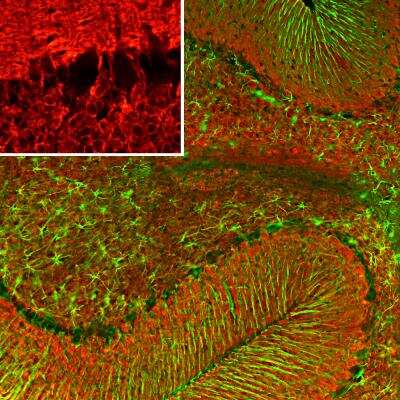 Immunohistochemistry Free-Floating: visinin-like 1 Antibody (2D11) [NBP2-25166]