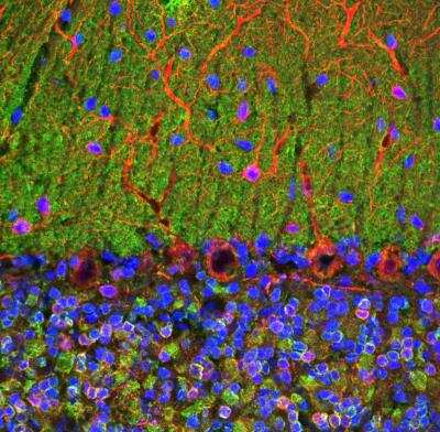 Immunocytochemistry/ Immunofluorescence: visinin-like 1 Antibody (3A9) [NBP2-25167]