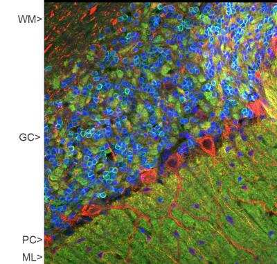 Immunohistochemistry: visinin-like 1 Antibody [NBP2-25168]