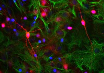 Immunocytochemistry/ Immunofluorescence: visinin-like 1 Antibody [NBP2-25169]