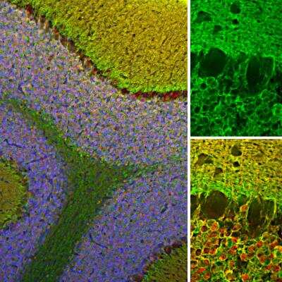 Immunohistochemistry Free-Floating: visinin-like 1 Antibody [NBP2-25169]
