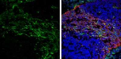 Immunohistochemistry-Frozen: visinin-like 1 Antibody [NBP2-20862]