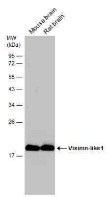Western Blot: visinin-like 1 Antibody [NBP2-20862]