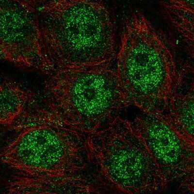 Immunocytochemistry/ Immunofluorescence: wdyhv1 Antibody [NBP2-58578]