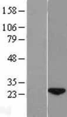 Western Blot: wdyhv1 Overexpression Lysate [NBL1-08565]