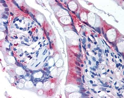 Immunohistochemistry: xCT Antibody - BSA Free [NB300-318]
