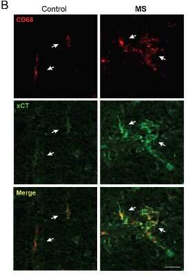 Immunohistochemistry-Paraffin: xCT Antibody - BSA Free [NB300-317]