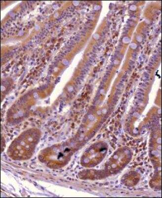 Immunohistochemistry-Paraffin: xCT Antibody - BSA Free [NBP2-88948]