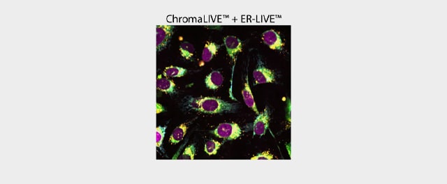 Chroma Live ER Live Image