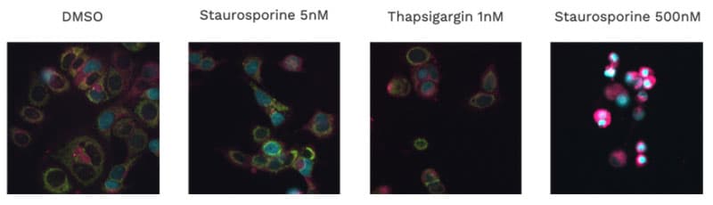 MCF-7 cells with ChromaLIVE at 24h in different conditions Fig 4