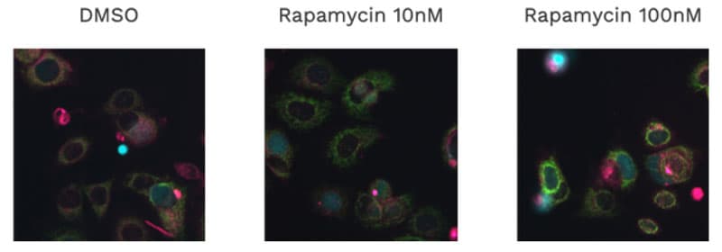MCF-7 cells with ChromaLIVE at 72h treated with Rapamycin