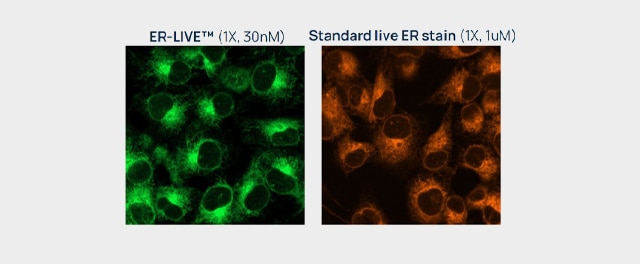 ER-LIVE™ delivers bright, stable endoplasmic reticulum labeling at nanomolar concentrations, minimizing disruption of native cel