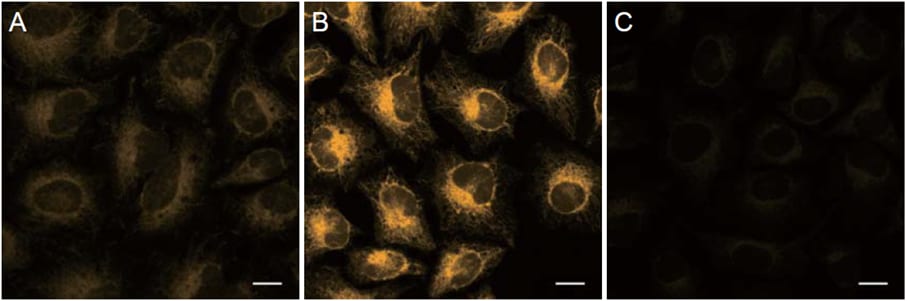 Detection of intracellular Fe2+ in HeLa cells in cells using FerroOrange