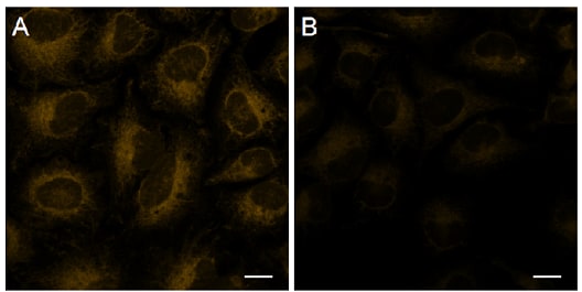 Detection of intracellular Fe2+ in HeLa cells in cells using FerroOrange