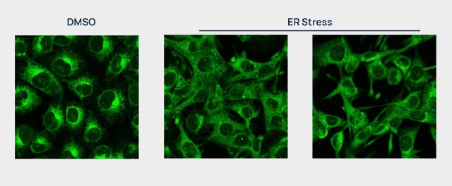 MCF7 cells stained with ER-LIVE™