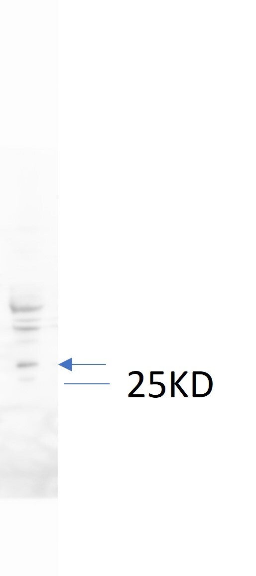 gamma-glutamyl hydrolase Antibody - BSA Free NBP3-03614