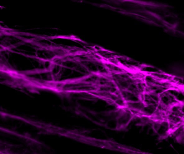 Mouse Decorin Antibody AF1060