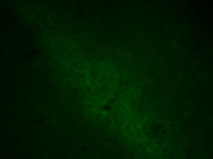 ACSL1 Antibody - BSA Free NBP1-89270