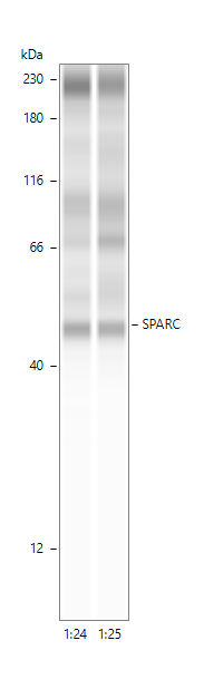 Human SPARC Antibody AF941