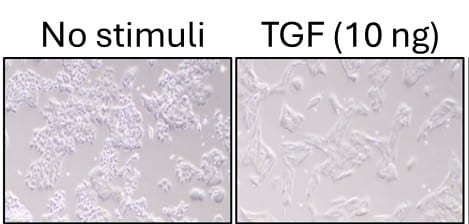 Recombinant Human TGF-beta 1 Protein 240-B