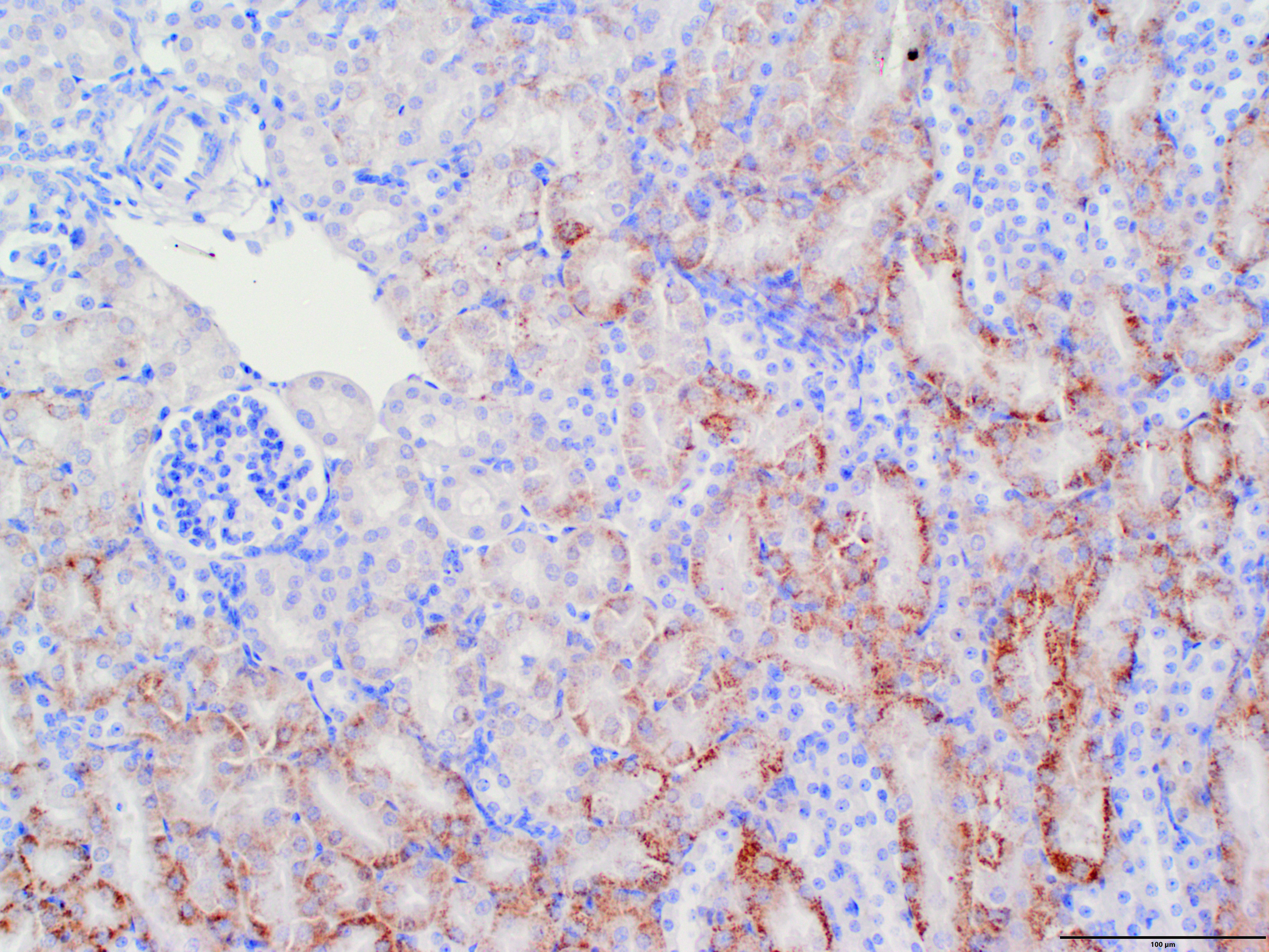 TIM-1/KIM-1/HAVCR Antibody - BSA Free NBP1-76701