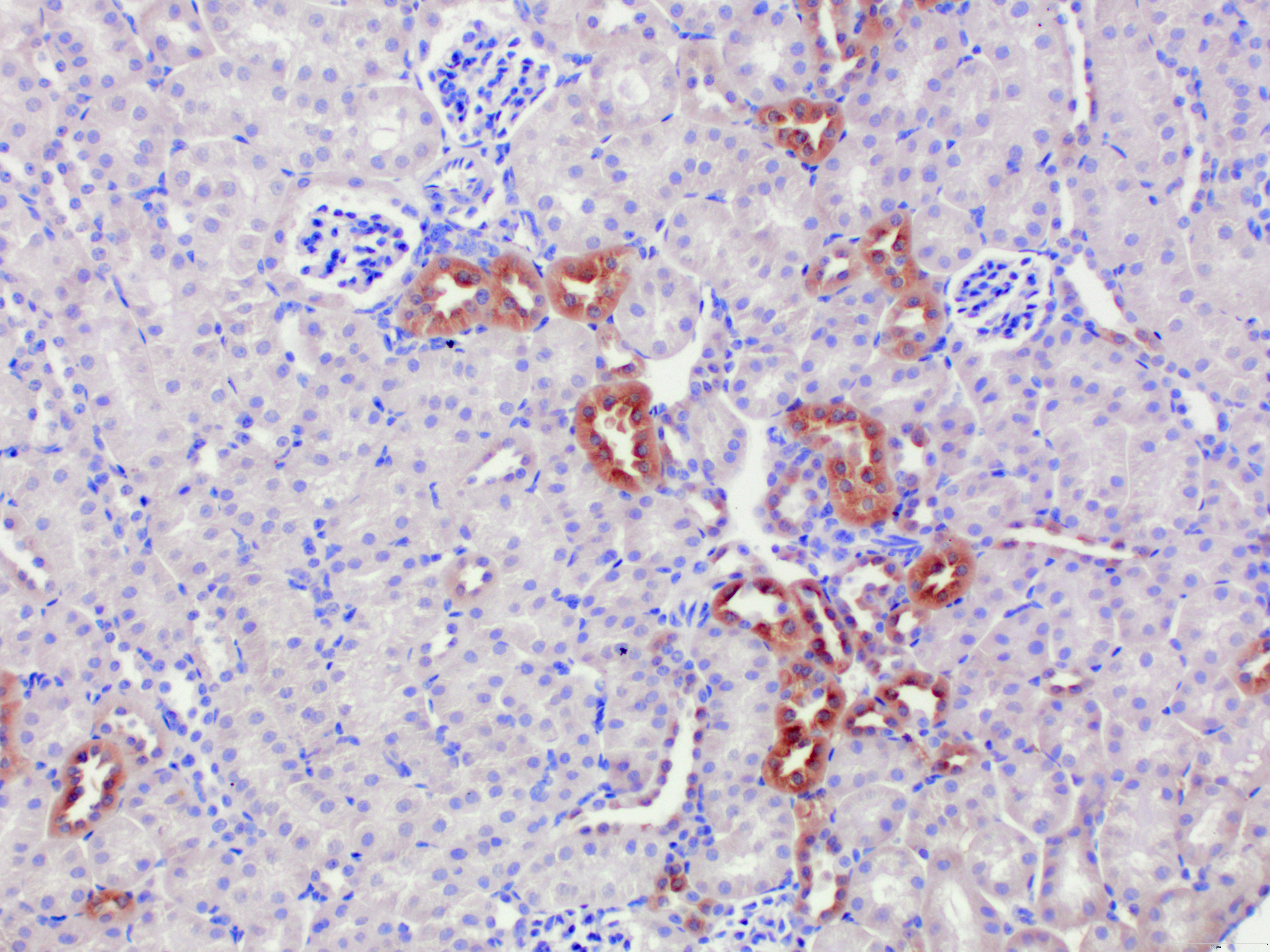 NIK/MAP3K14 Antibody - Azide and BSA Free NB100-56367