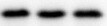 Human Fetuin B Antibody MAB17251