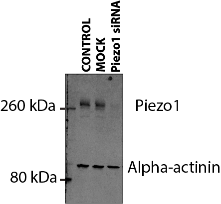 PIEZO1 Antibody (2-10) NBP2-75617
