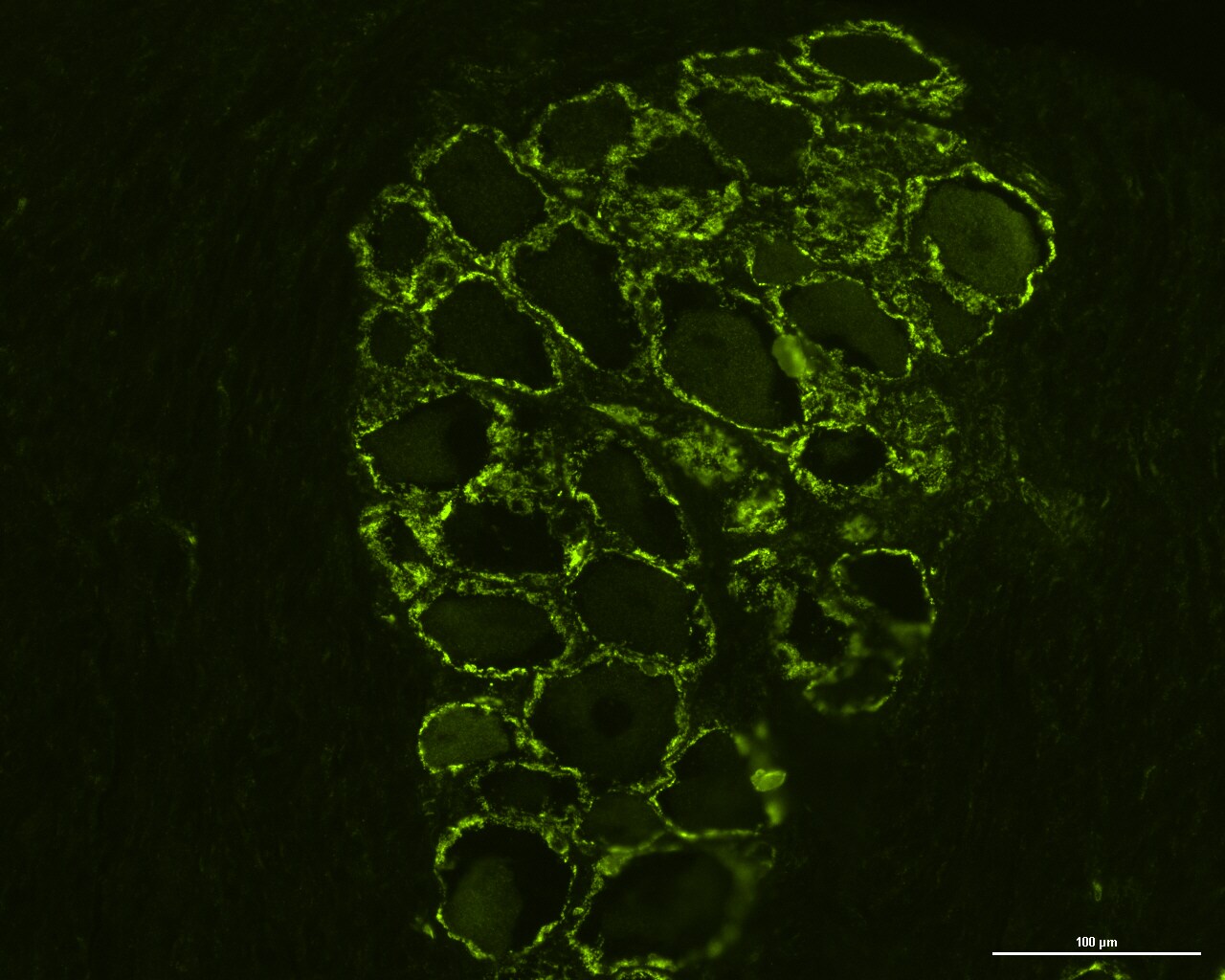 GPR55 Antibody - BSA Free NB110-55498
