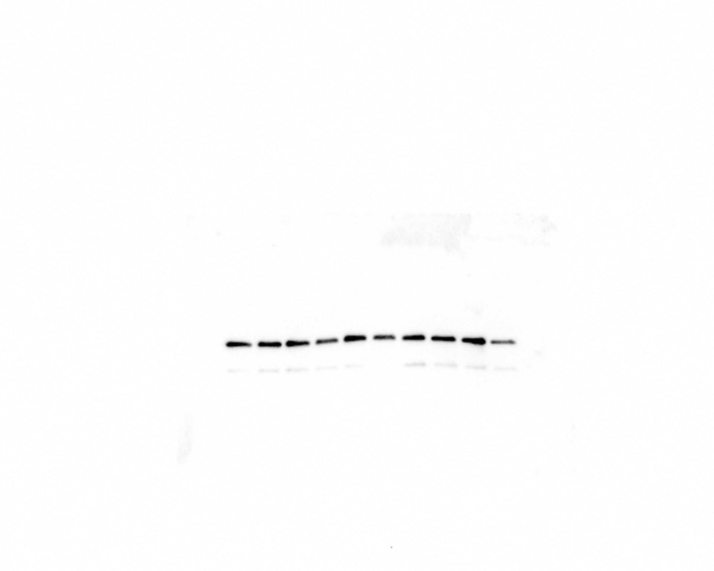 beta-Actin Antibody (AC-15) [HRP] NB110-67828H