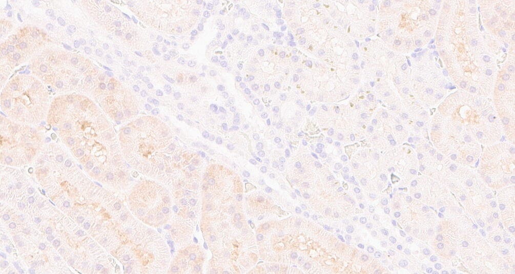 Activin RIA/ALK-2/Activin Receptor Type 1 Antibody - BSA Free NBP1-33096