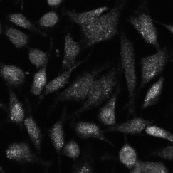 CDT1 Antibody - BSA Free NB100-2567