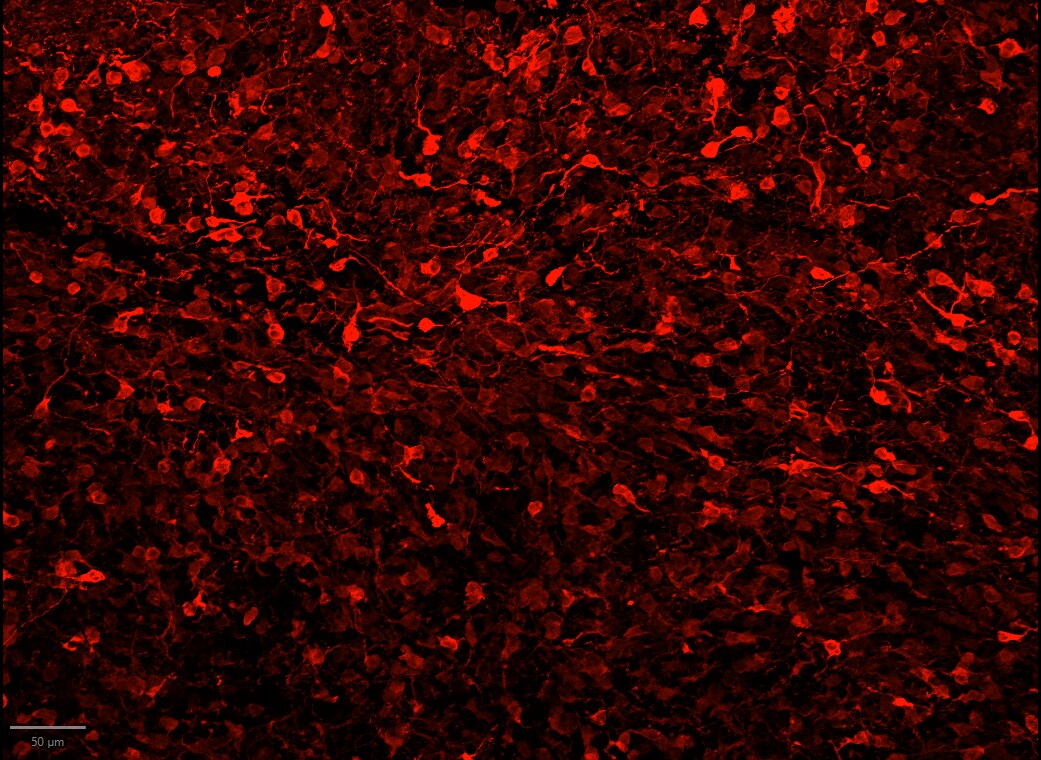 Human/Mouse/Rat DARPP‑32 Antibody AF6259