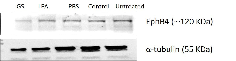 Mouse EphB4 Antibody AF446