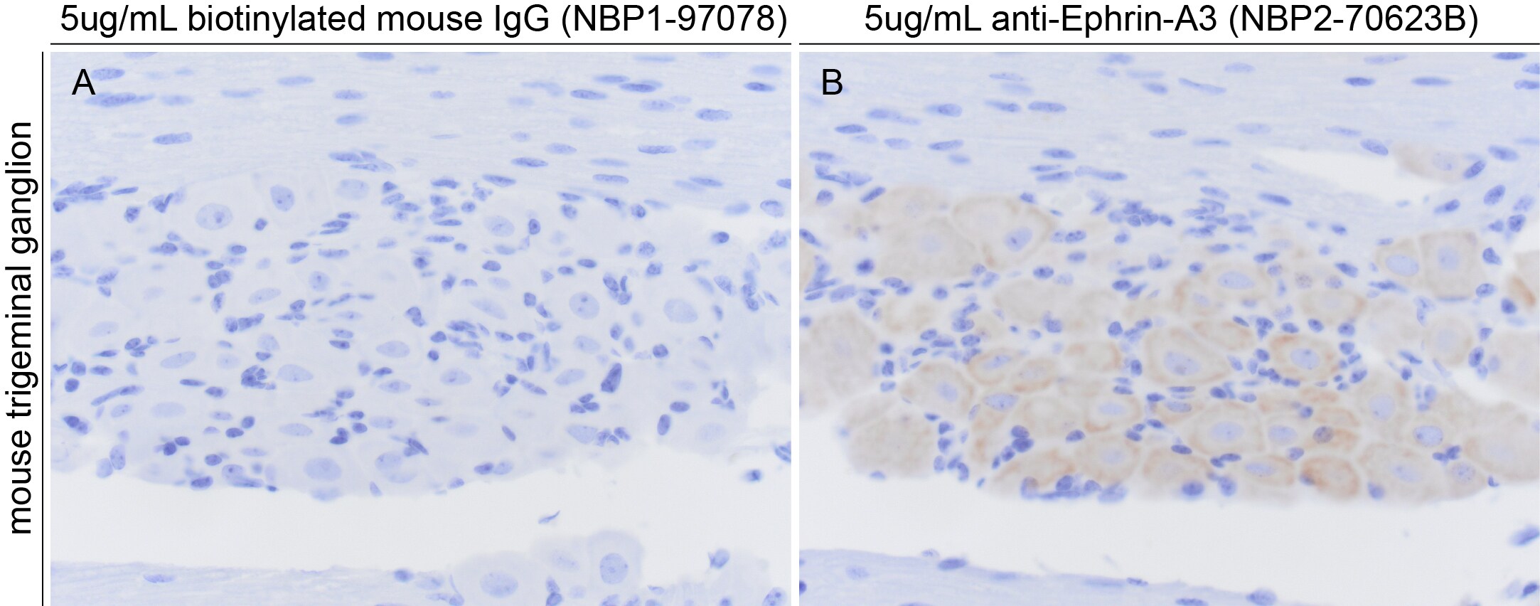 Ephrin-A3 Antibody (OTI4A4) [Biotin] NBP2-70623B