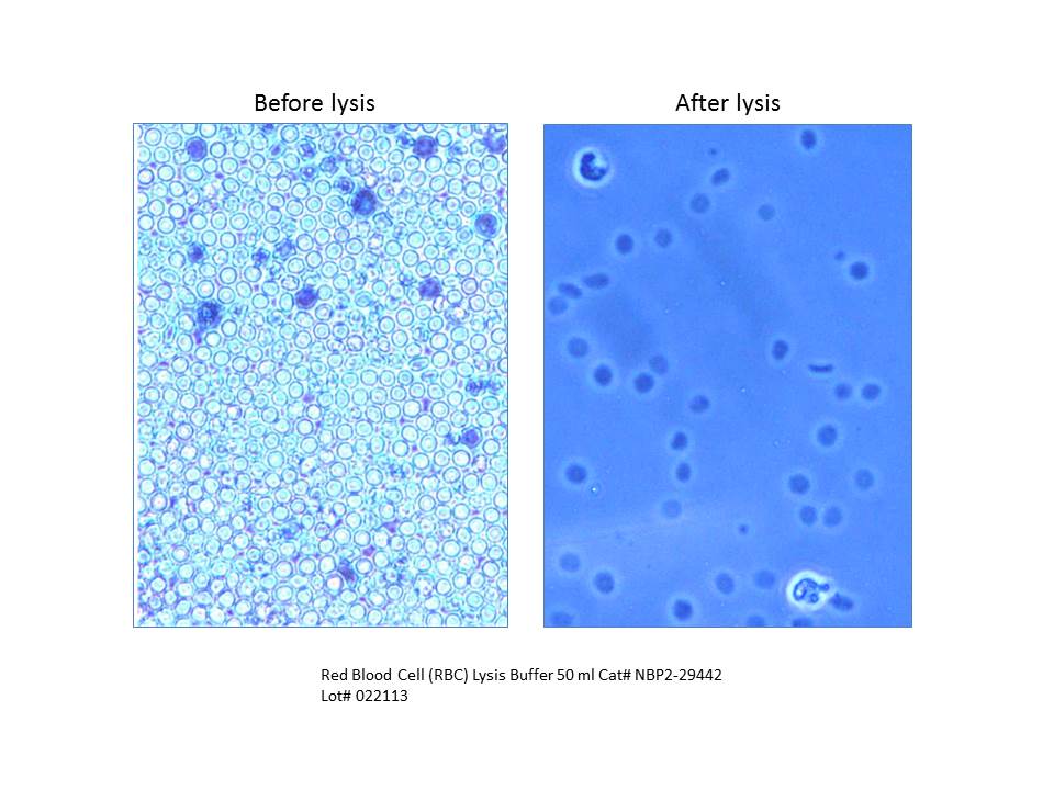 Red Blood Cell (RBC) Lysis Buffer NBP2-29442