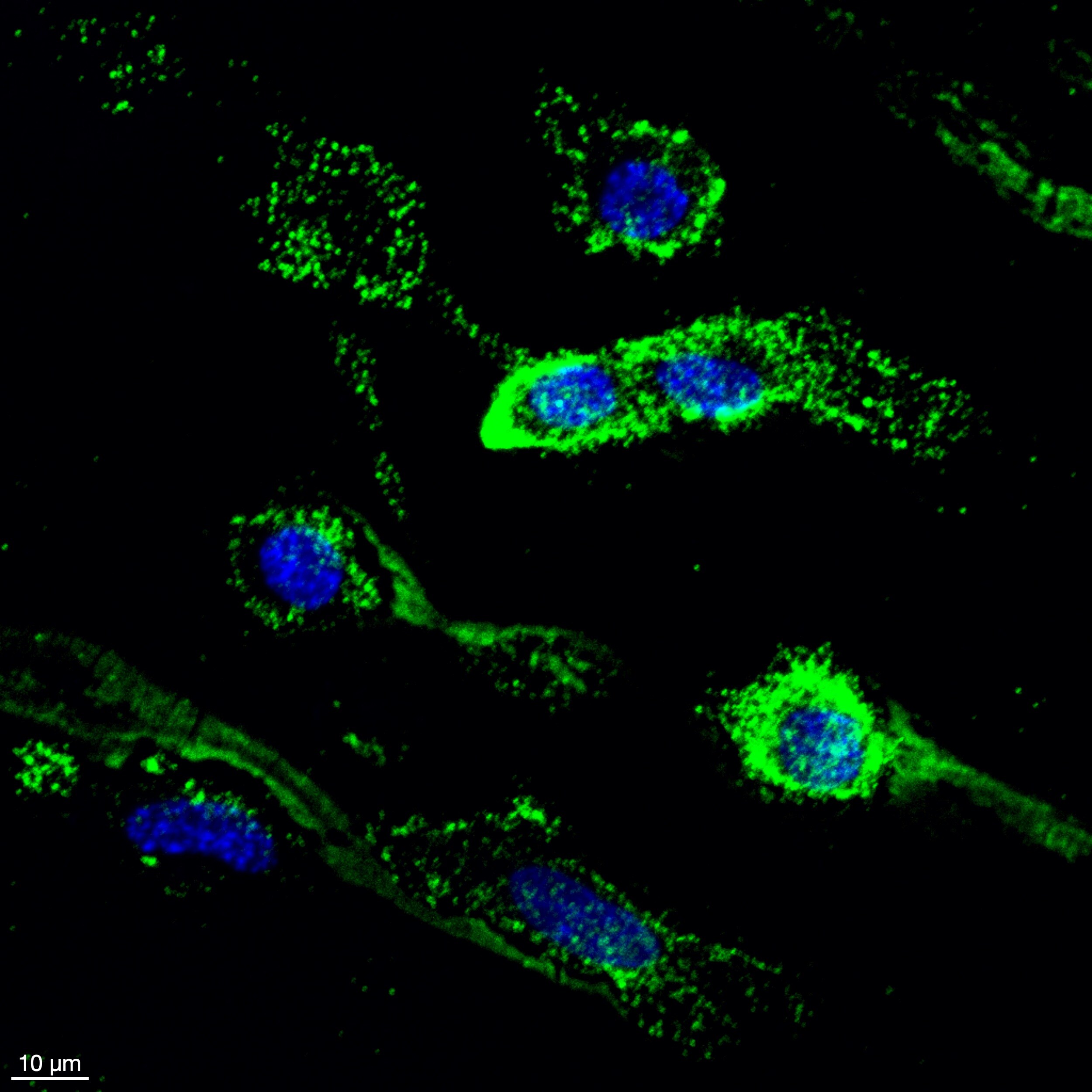 Human Galectin‑10 Antibody MAB5447