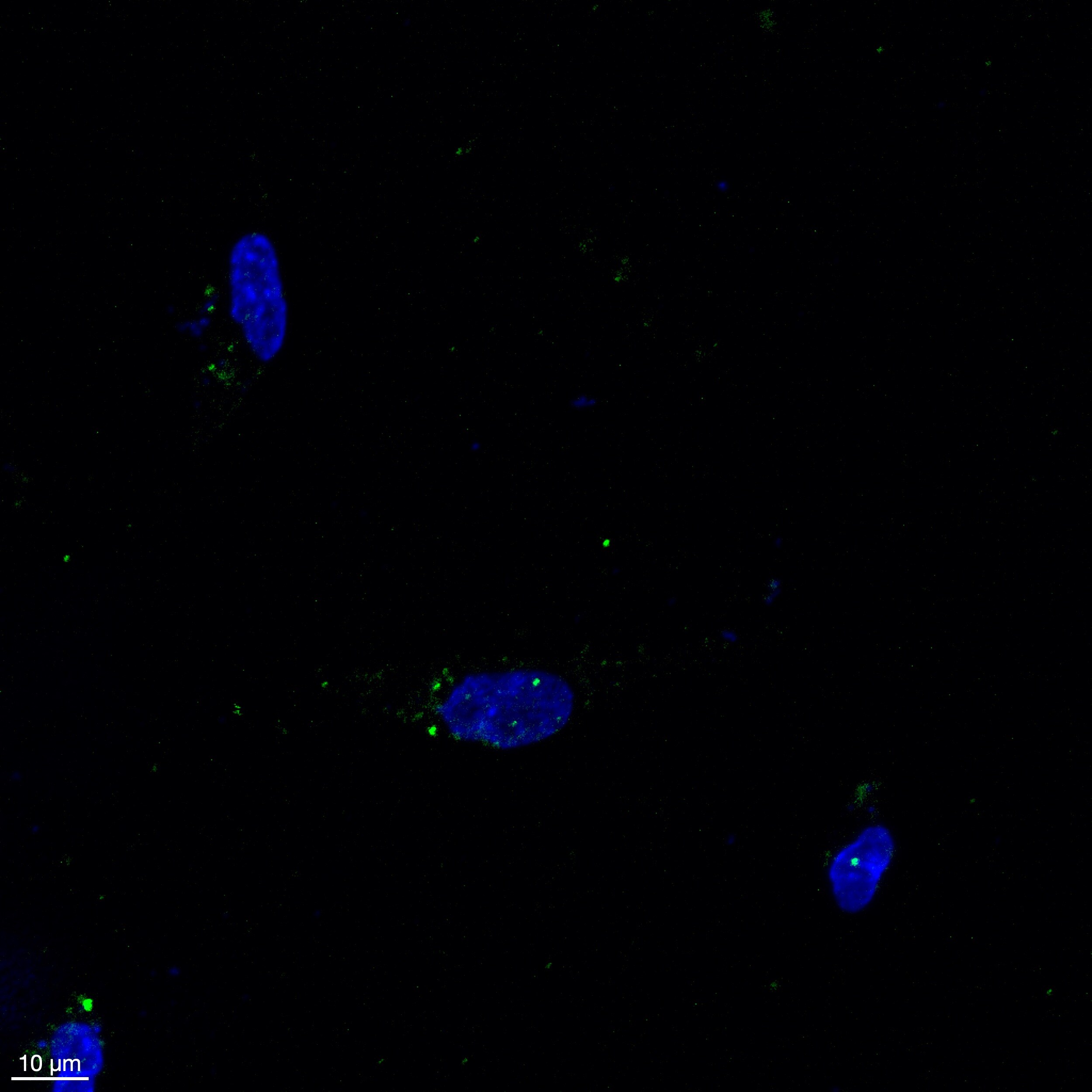 Human Galectin-12 Antibody MAB10157